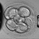 New Test Will Increase IVF Success, Reduce Multiple Births